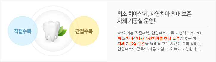 직접수복 VS 간접수복