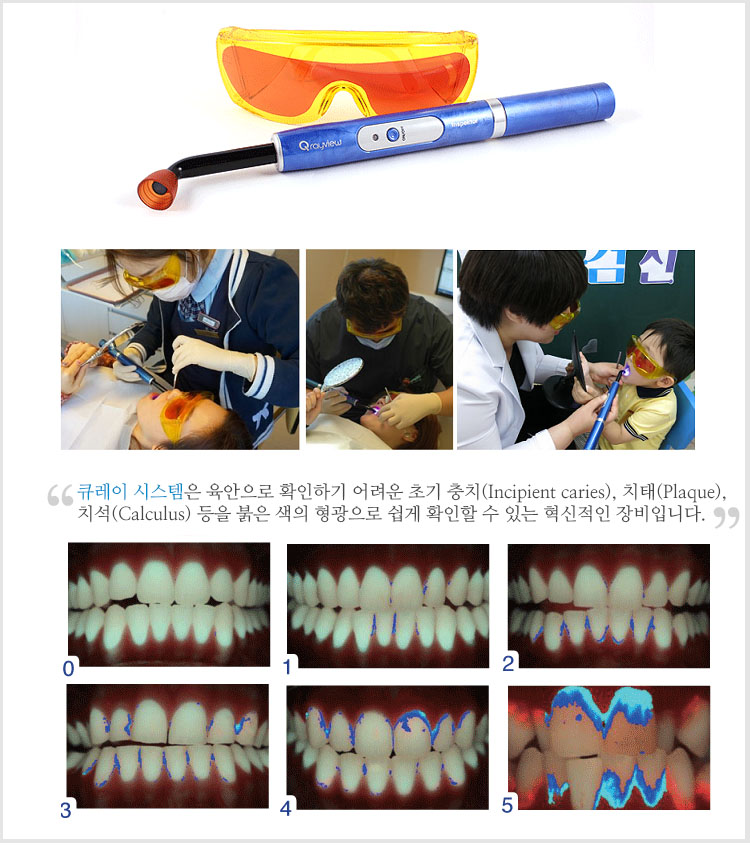 Q-ray view 충치 관리 시스템