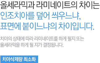올세라믹과 라미네이트의 차이는 인조치아를 덮어 씌우느냐,표면에 붙이느냐의 차이입니다.
