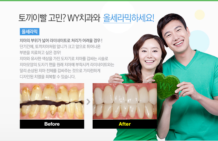 토끼이빨 고민?WY치과와 올세라믹 하세요