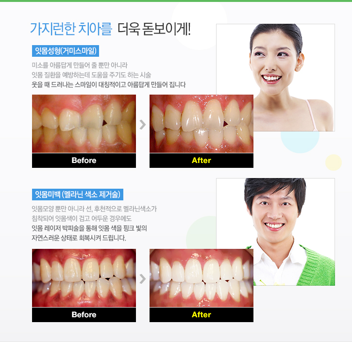 가지런한 치아를 더욱 돋보이게!