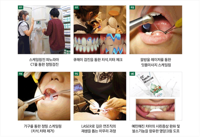 구강검진절차