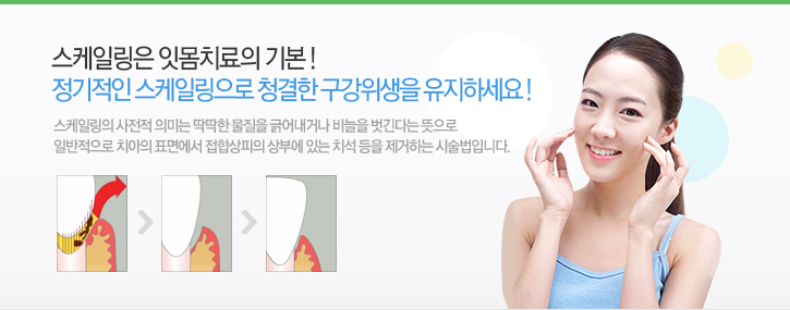 스케일링은 잇몸치료의 기본! 정기적인 스케일링으로 청결한 구강위생을 유지하세요!